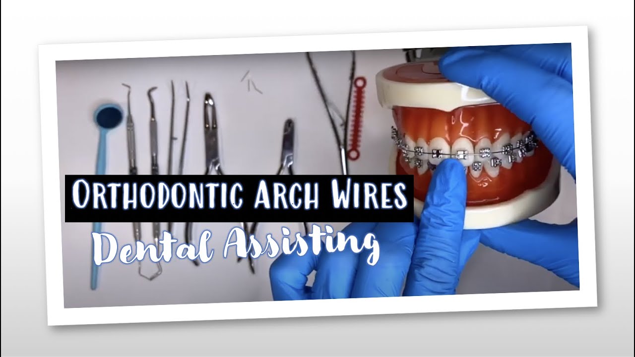 placement-of-orthodontic-archwires-youtube