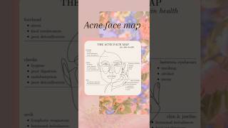 Acne face map🎀🎀 #acne #face #skincare #shorts #aesthetic