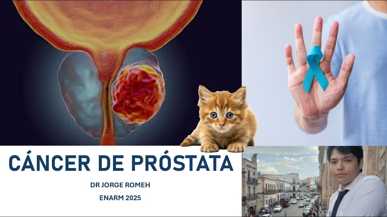 CÁNCER DE PRÓSTATA // ENARM 2025 // GPC // TAMIZAJE