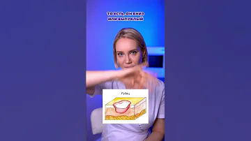 Как убрать рубцы и шрамы?
