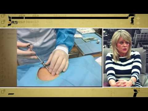 Vídeo sobre colocación de pellet en terapia hormonal con Sottopelle