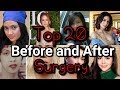 Filipino celebrities shocking transformation before and after surgery  showbiz updates