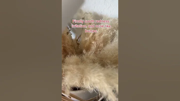 Struggling to Find a Good Rosacea Treatment? We're Here to Help! | Musely Skincare #shorts