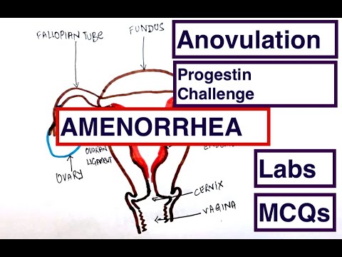 Amenorrhea: Progestin Challenge Test | Anovulation | PCOS  | USMLE | MCQs