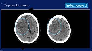 Case Review of Neuroradiology  Course Sample