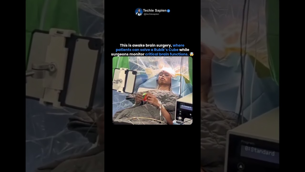 Why Patients Solve Rubik’s Cubes During Brain Surgery 🤯