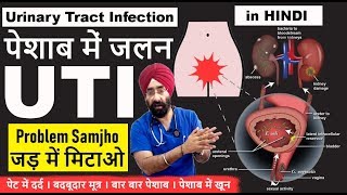यूरिन इंफेक्शन | Urinary Tract Infection : Cause to Cure | UTI Explained in Hindi | Dr.Education