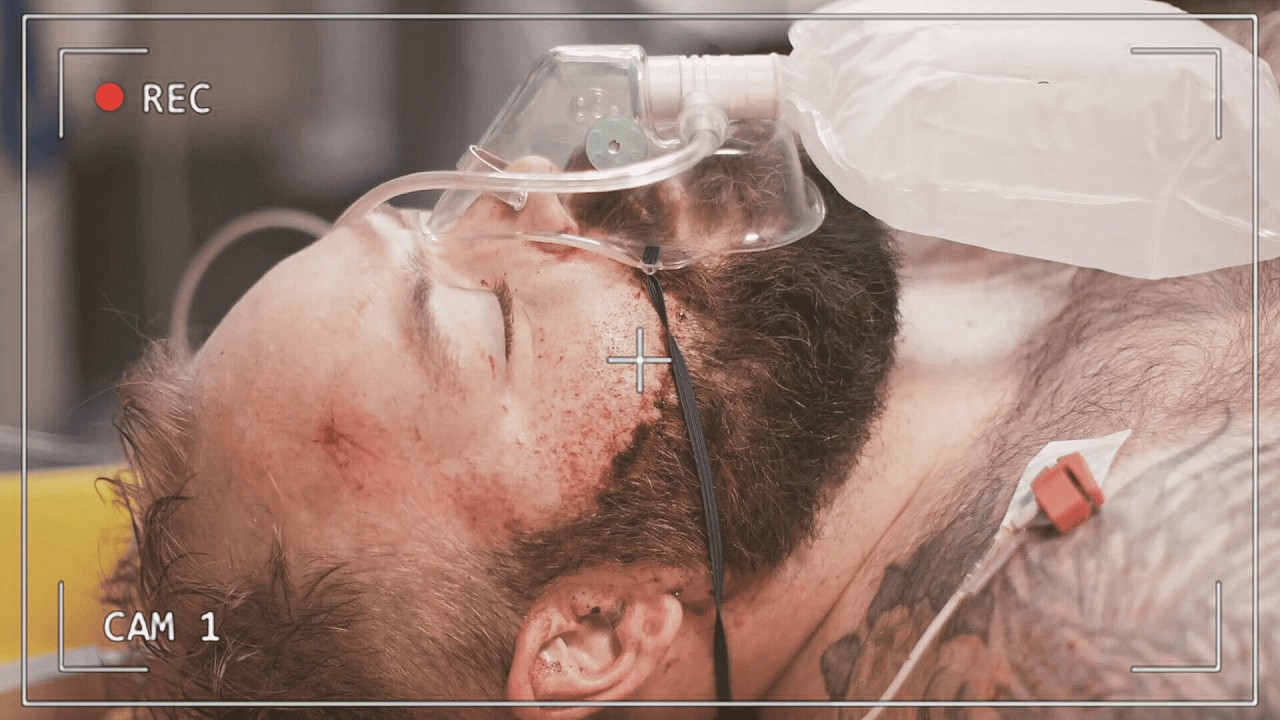 Surgeons Are Amazed He Can Still Stand... | 999 Critical Condition Full Episode S3 E2