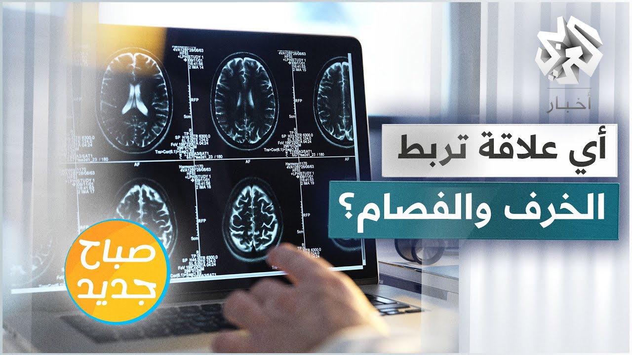 دراسة حديثة تكشف التشابه بين انفصام الشخصية والخرف
