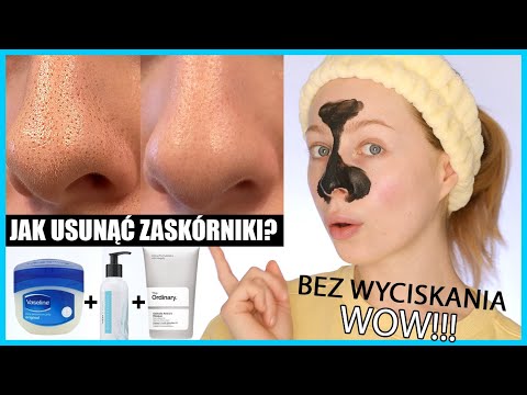 Wideo: 4 sposoby na usuwanie plam na skórze twarzy