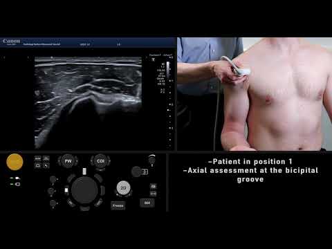 Ultrasound Tutorial: MSK Series: Shoulder / Rotator Cuff | Nation - YouTube