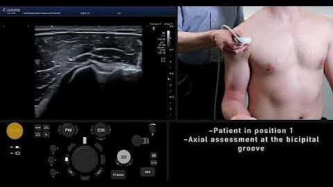 Ultrasound Tutorial: MSK Series: Shoulder / Rotator Cuff | Radiology Nation
