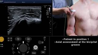 Ultrasound Tutorial: MSK Series: Shoulder / Rotator Cuff | Radiology Nation