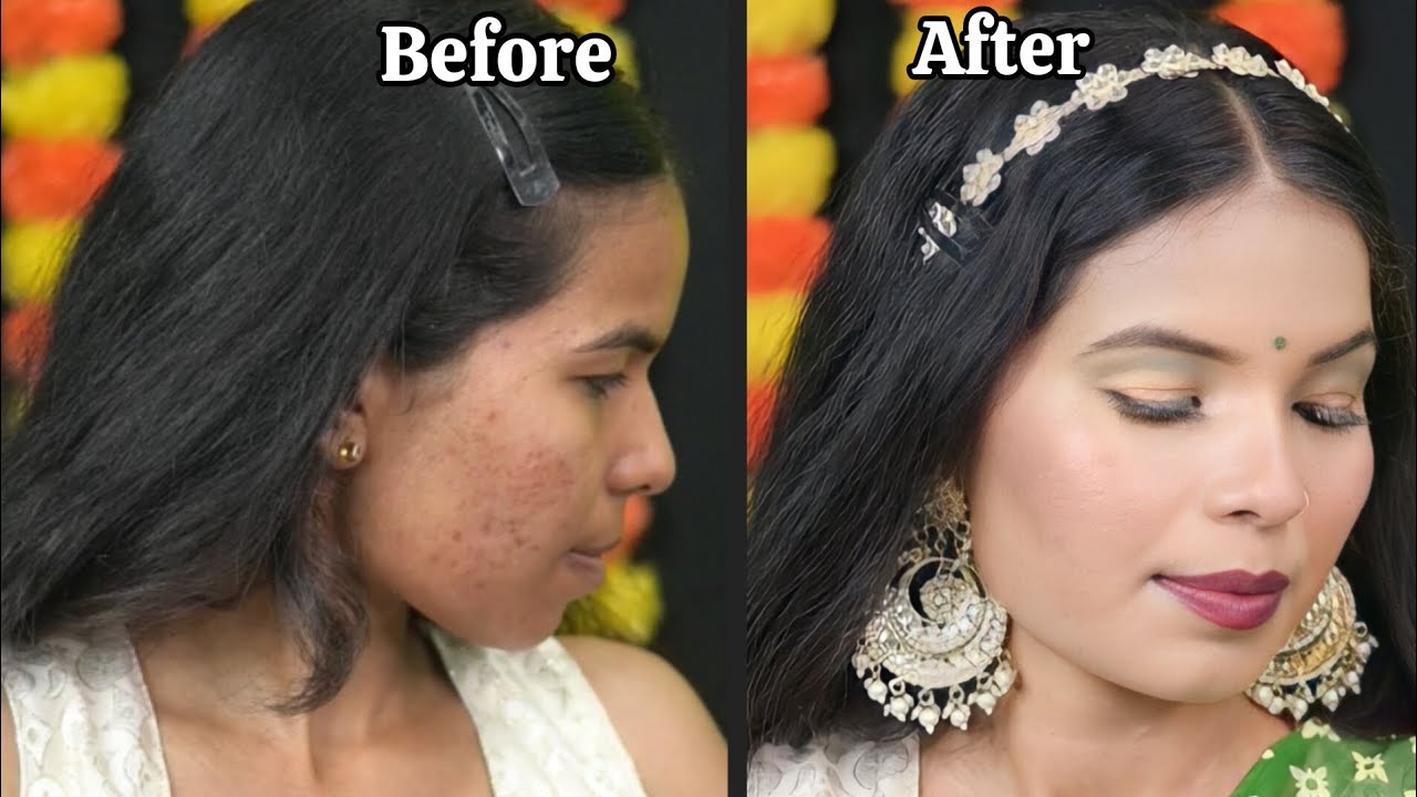 HOW TO COVER ACNE PRONE SKIN?🌷🌷Flawless base makeup