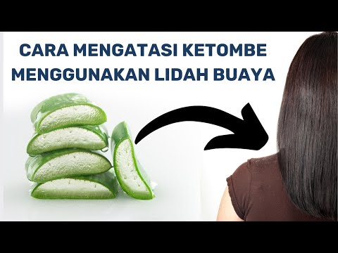 Lidah Buaya Ketombe