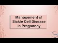 RCOG GUIDELINE Management of Sickle Cell Disease
