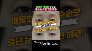 일본에서도 찾아온다? 자연스러운 눈매 완성! 50대 눈성형 리얼 변화 Before &amp; After #shorts