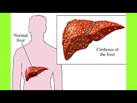 Video: Mëlçia Me Perime 