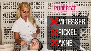 Teenager Pfege -So bekommt ihr eure Haut in den Griff