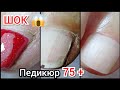 ШОК😱/ПЕДИКЮР 7️⃣5️⃣+❤️/много СУХОЙ кожи/очень ПРИЛИПШАЯ КУТИКУЛА😬/комбинированная обработка🤓