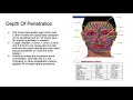 Microneedling | NASNPROtv | Elaine Sterling