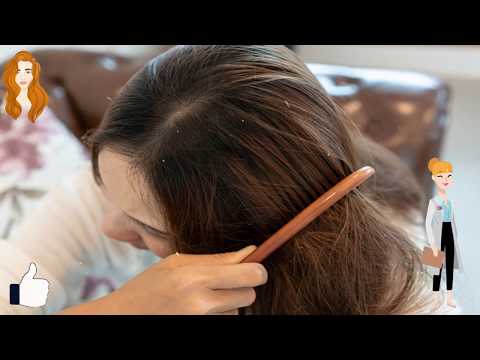Video: 10 përbërësit më toksikë në produktet e flokëve