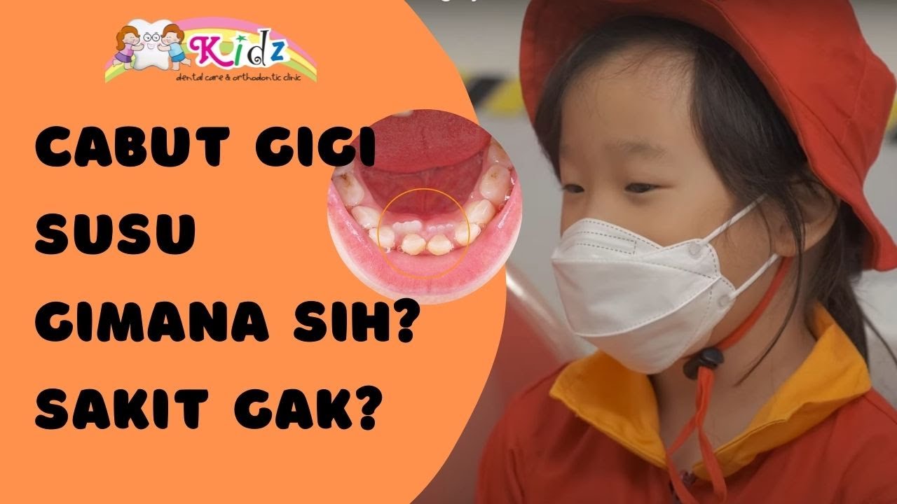 Cabut gigi susu di dokter gigi seperti apa ya ? Sakit ga ya ?