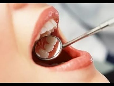 ВИЧ в стоматологии.