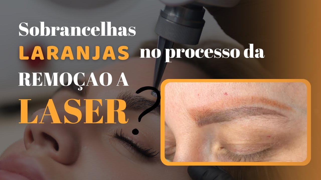 Sobrancelhas laranjas após a Remoção a laser?