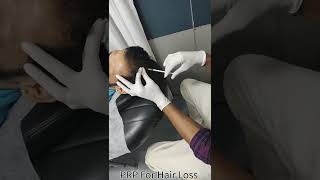 PRP Treatment for Hair Loss.