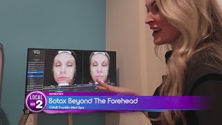 OVME Botox