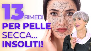 Pelle secca? Questi sono i 13 migliori rimedi naturali fai da te (che uso da 25 anni) screenshot 3