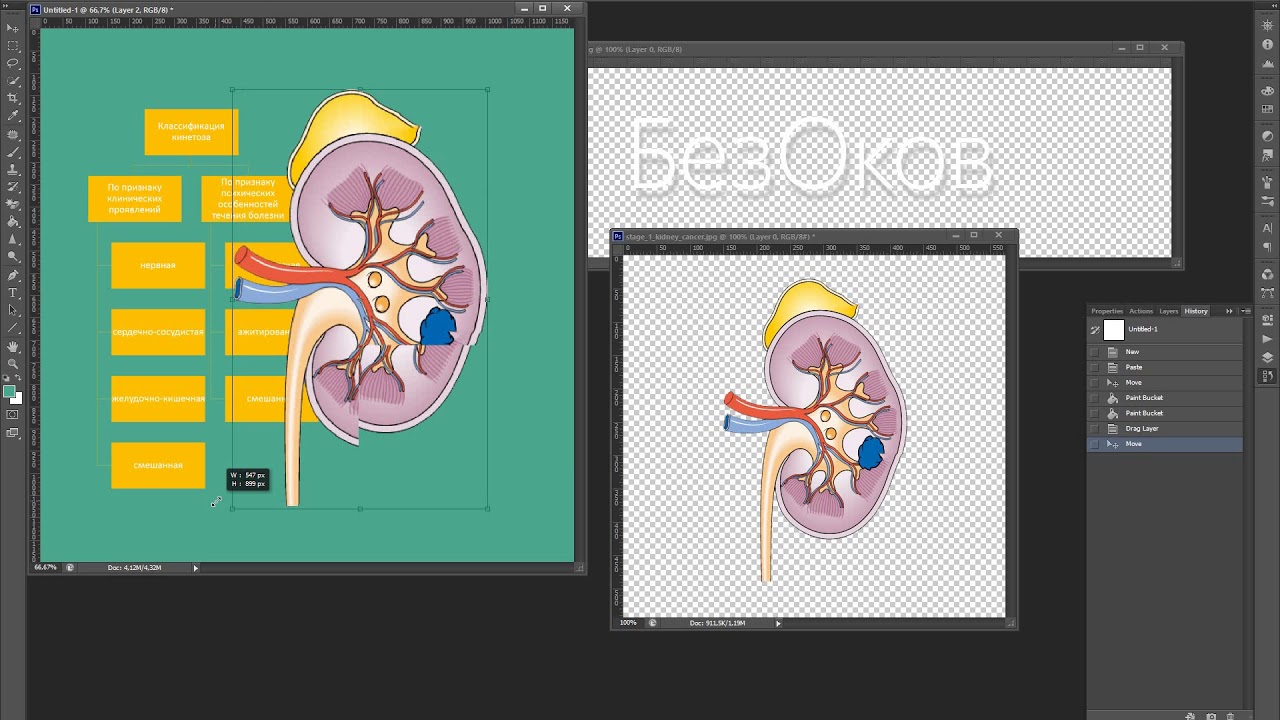 Пример полной картинки про кинетоз - YouTube