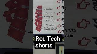 #radiologyshorts #radiology #radiographer #redtechshorts #education