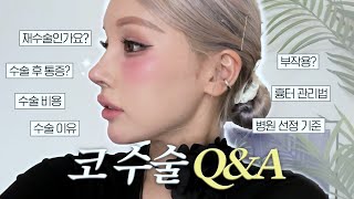 [코수술 Q&A] 역대급 예쁜 코..❤️ 정말 전~~~부 알려드릴게요‼️