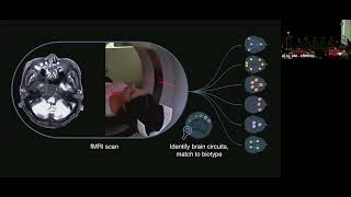 Revolutionizing Therapeutics: Precision Approaches to Cognitive Health