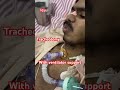 #hospital #doctor #icu #icudoctor #ytshorts