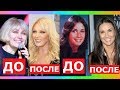 ЗВЁЗДЫ, которым ПЛАСТИКА пошла НА ПОЛЬЗУ!