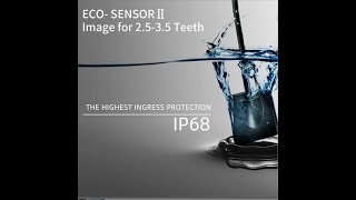 Celebrity APPLEDENTAL ECO SENSOR DIGITAL DENTAL X-RAY (RVG ) INSTALLATION Profile