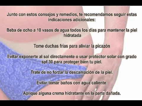 Quemaduras en la piel remedios caseros