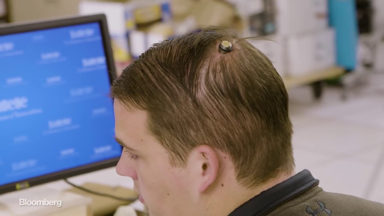 This Brain Implant Could Change Lives - YouTube