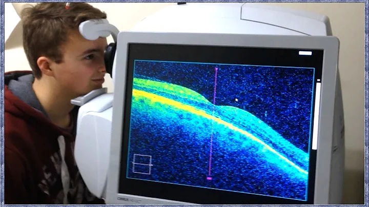 What is OCT Scanning? (Optical Coherence Tomography) - DayDayNews