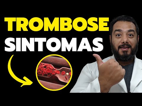 Quais os sintomas