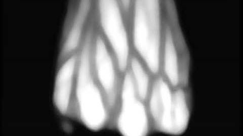 Hand-dorsa vein used as a biometrics for verifying people