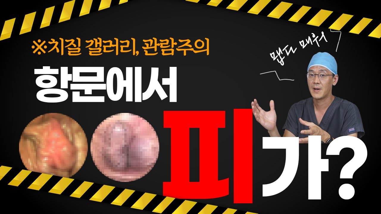 항문출혈! 혈변의 원인은? 사진으로 보는 항문질환, 치질, 치핵 - YouTube