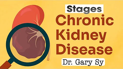 Understanding Chronic Kidney Disease Stages - Dialysis to Transplant - Dr. Gary Sy