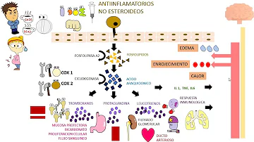 ¿Cuál es un buen antiinflamatorio que no sea un AINE?