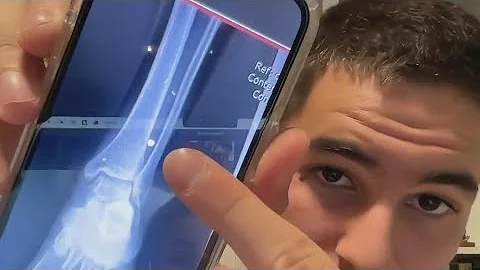 Israeli teen survives rave massacre