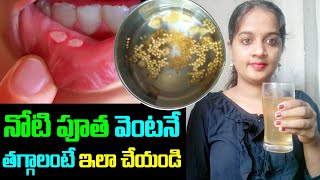 నోటిపూత తగ్గాలంటే ఇలా చేయండి | Home Remedy for Noti putha | mouth ulcer  remedy in Telugu | Pootha