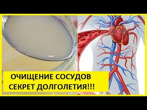 ЧИСТКА СОСУДОВ ~√^' Чистим сосуды народными средствами. Рецепты.